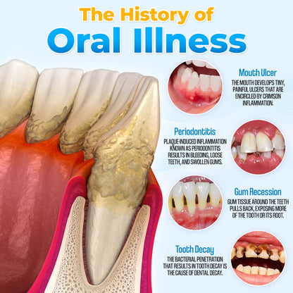 🐝MicroSmile Bee Venom Gum Repair Mousse 🦷