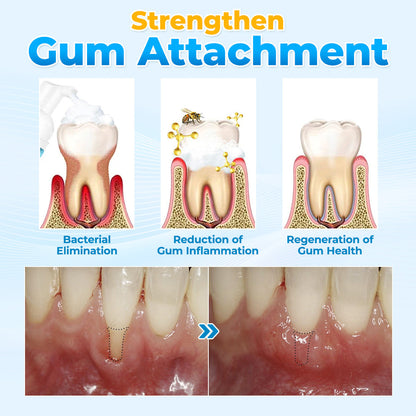 🐝MicroSmile Bee Venom Gum Repair Mousse 🦷